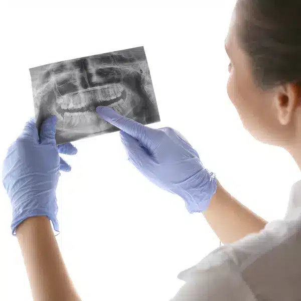 radiologie dentara, rasmindent.ro