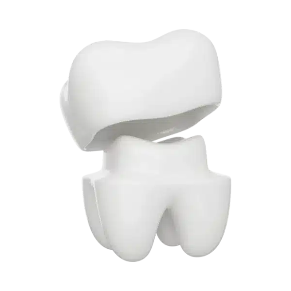 coroana dentara, rasmindent.ro