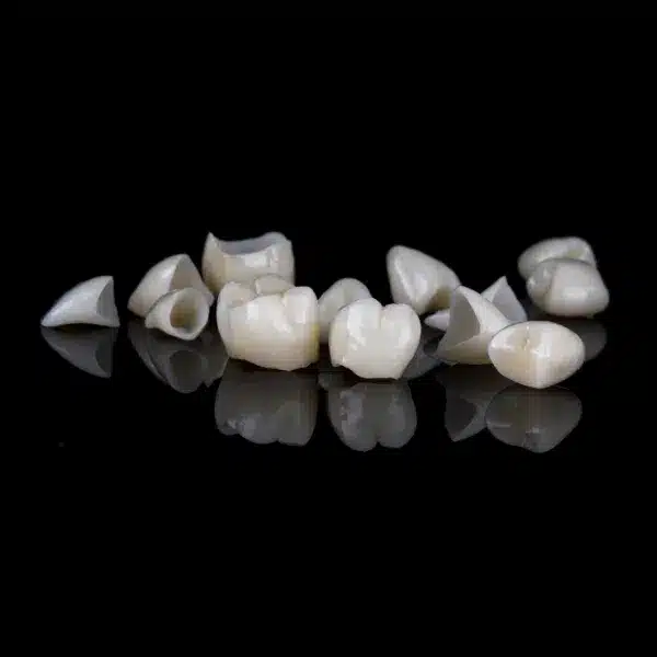 coroane ceramice, rasmindent.ro