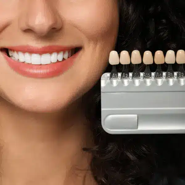 clinica estetica dentara, rasmindent.ro