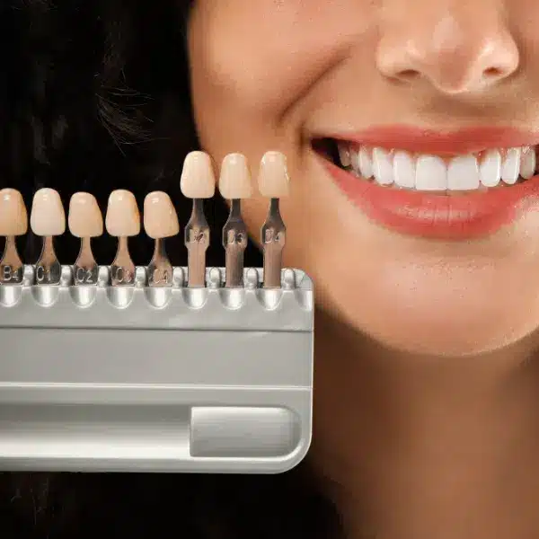 estetica dentara bucuresti, rasmindent.ro