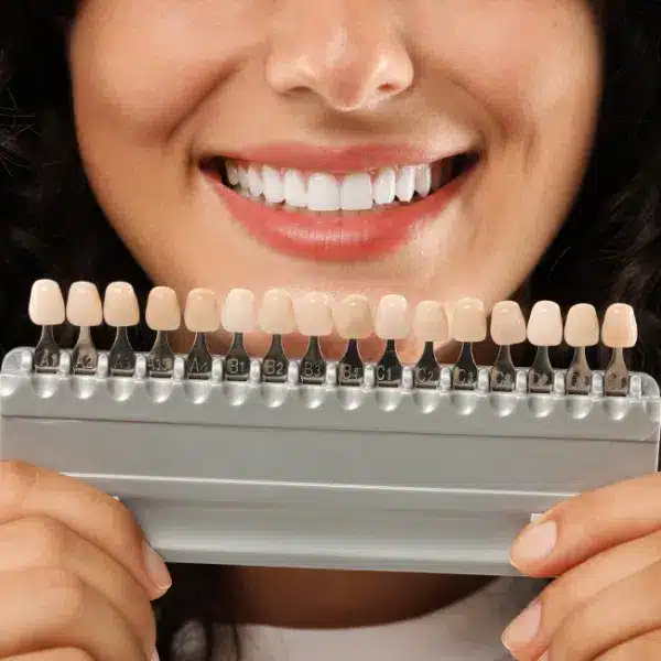 fatete dentare, rasmindent.ro