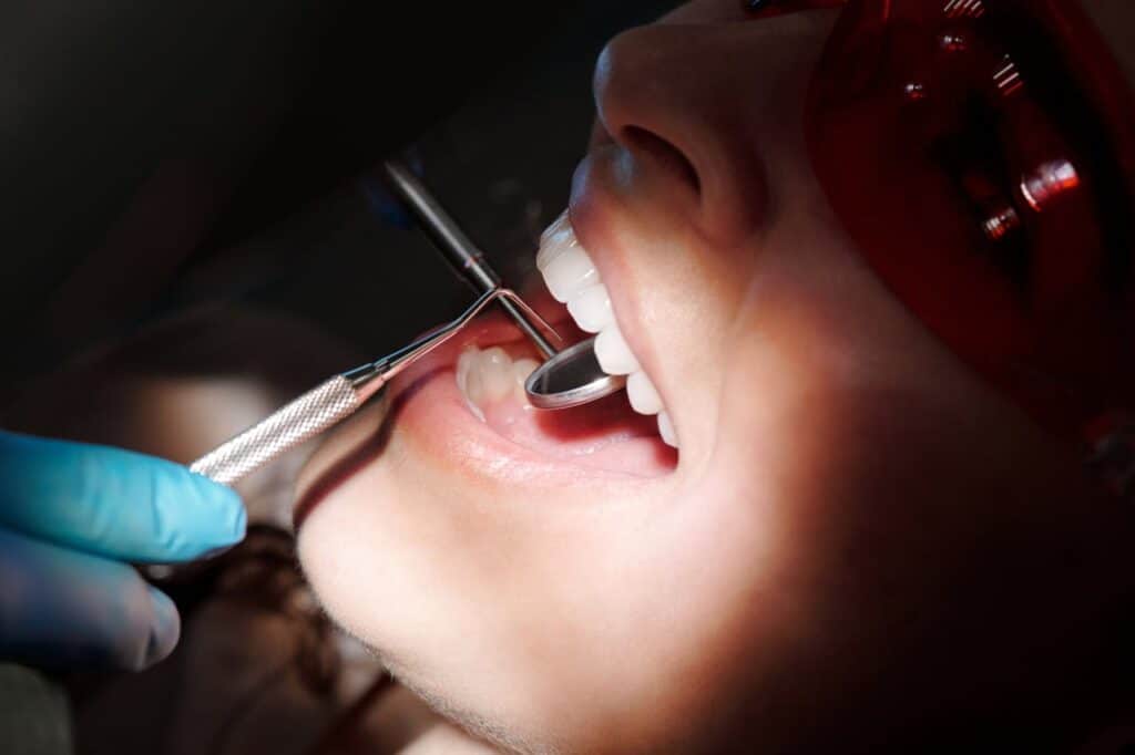 pachet igienizare dentara, rasmindent.ro