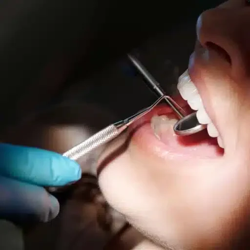 tratamente stomatologice, cimentare dentara, rasmindent.ro