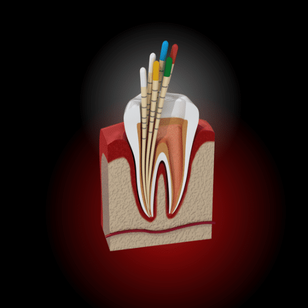 stomatologie sector 5, endodontie, rasmindent.ro