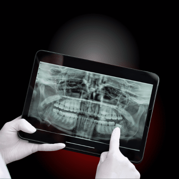 stomatologie sector 5, odontoterapie, rasmindent.ro