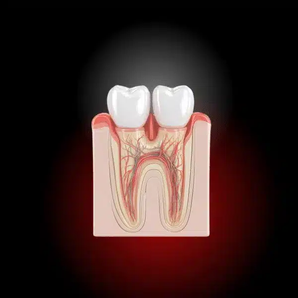 tratamente stomatologice, tratament abces dentar, rasmindent.ro
