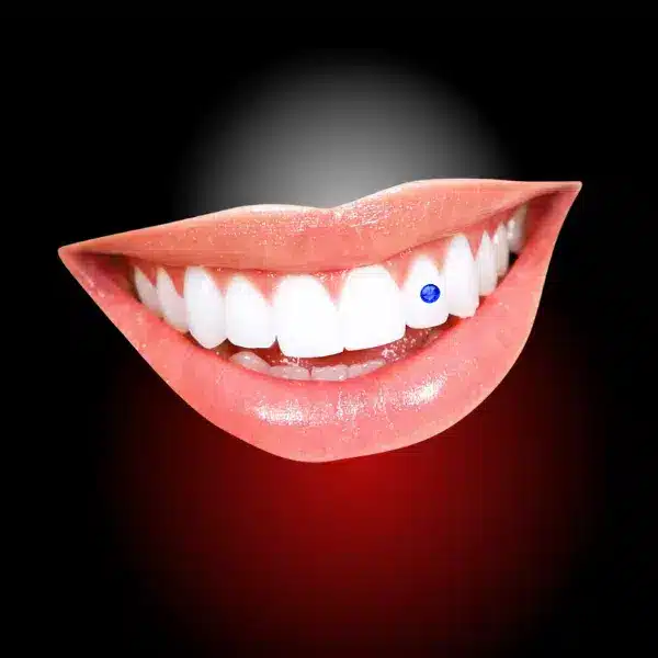 estetica dentara, bijuterie dentara, rasmindent.ro