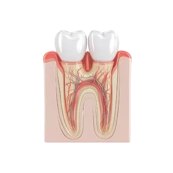 parodontologie, chiuretaj dentar, rasmindent.ro