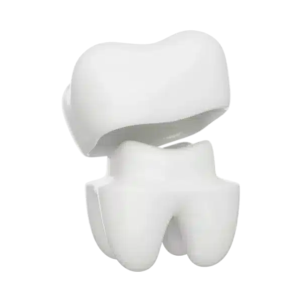 protetica dentara, coroane dentare, rasmindent.ro