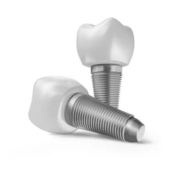 implantologie, implant dentar, rasmindent.ro