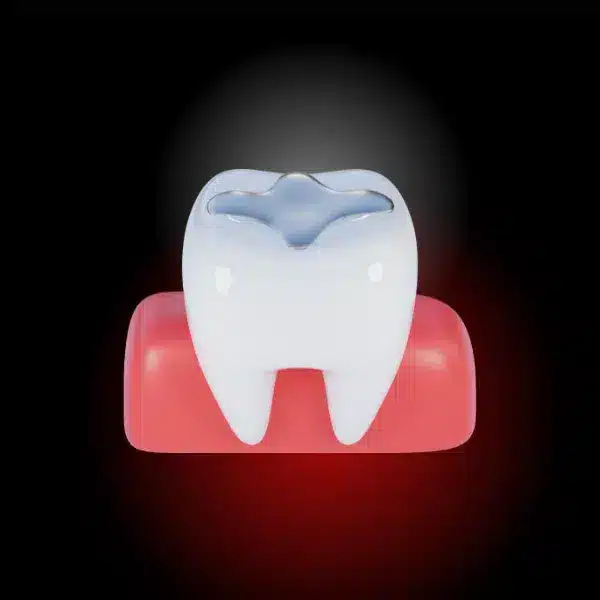 odontoterapie, tratament carii, rasmindent.ro